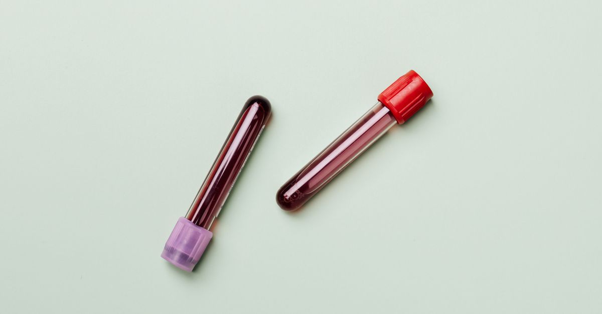 Albumina nel sangue - Cos'è e perché è importante