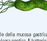L'Esperto risponde: infezione gastrica da Helicobacter pylori