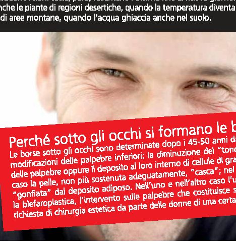 Perché sotto gli occhi si formano le borse?