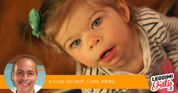 Scopriamo la sindrome rara dagli occhi a stella e del carattere da coktail party