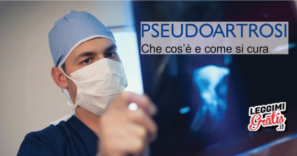 Pseudoartrosi: Cos'è e come si cura